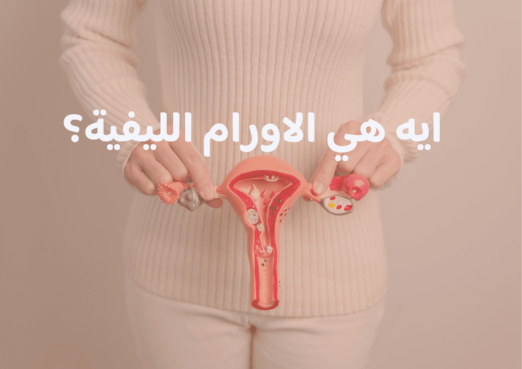 الأورام الليفية